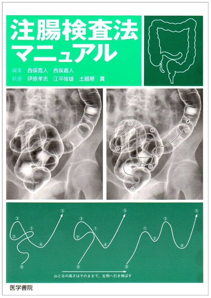 注腸X線検査の標準化 注腸X線検査の標準化―1cmの大腸癌を見逃さない』｜感想